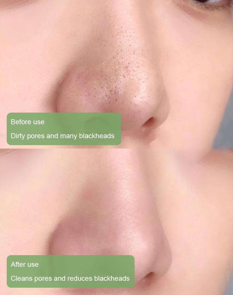 PurifyMist™ — Unleash Clear, Radiant Skin That Glows with Confidence